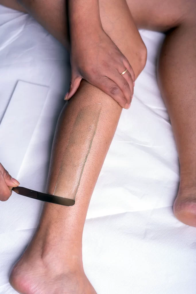 prestation_epilation